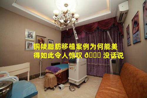 铜陵脂肪移植案例为何能美得如此令人惊叹 🐛 没话说